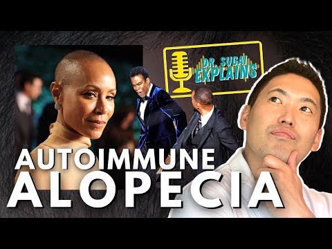 Dermatologist Explains: Autoimmune Alopecia (Alopecia areata)