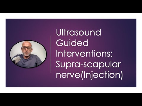 Ultrasound Guided Interventions: Suprascapular Nerve (Injection) #ultrasound