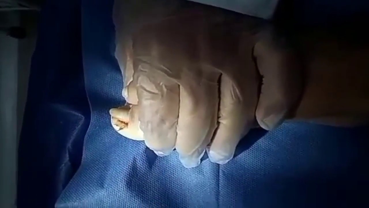 David Alfredo Castillo Molina-4