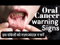 Mouth Cancer Symptoms In Hindi Early Signs Of Oral Cancer