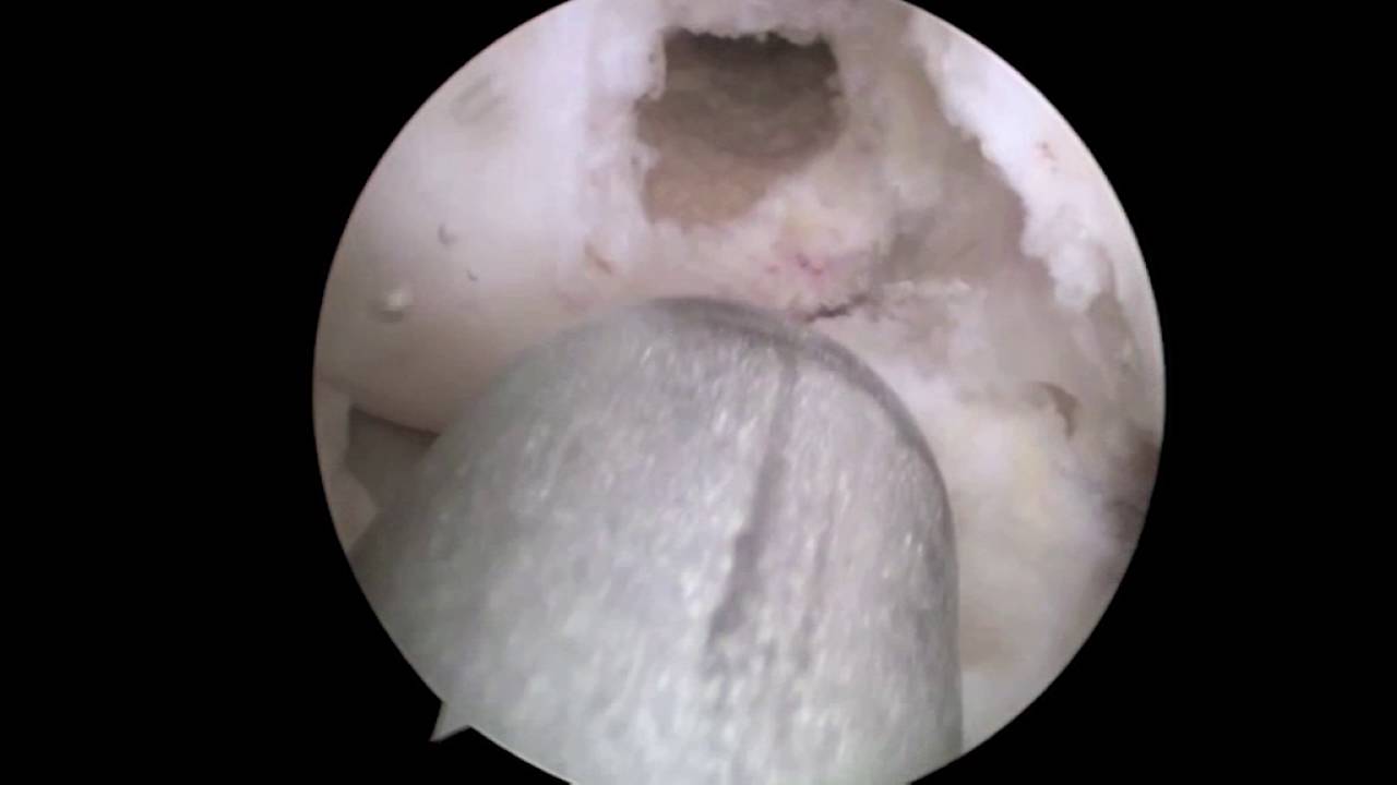 Juan Ignacio Erquicia-5