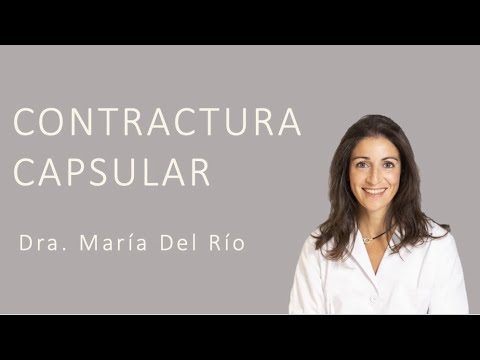 Contractura capsular