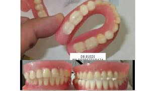 Download lagu gigi palsu terbaru nyaman simpel tinggal pakai full acrilik sintetis mp3 Download lagu gigi palsu terbaru nyaman simpel tinggal pakai full acrilik sintetis mp3