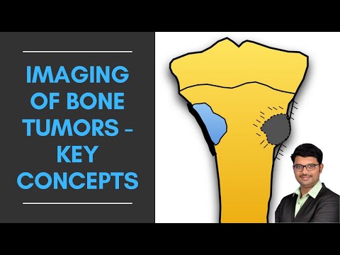 Imaging of Bone Tumors : Key Concepts | Dr. Venkatesh Manchikanti @ShadesofRadiology