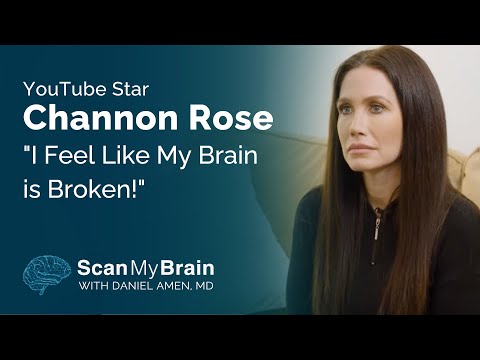 "I Feel Like My Brain is Broken!" | Scan My Brain x Channon Rose
