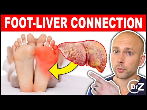 What Your FEET Can Tell You About Your Liver - Surprising Symptoms!