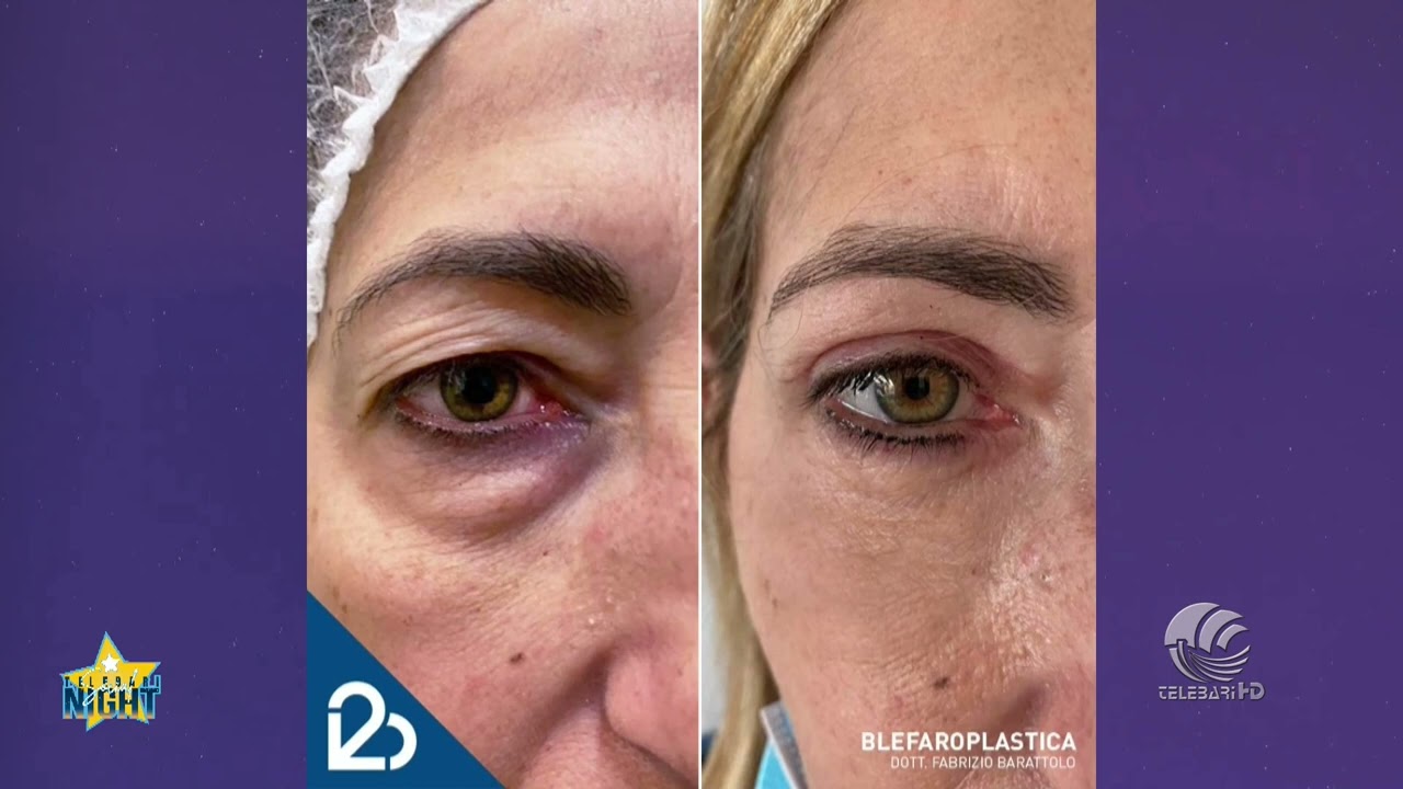 Fabrizio Barattolo-30