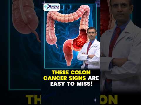 Colon Cancer Warning Signs You Should NEVER Ignore | Early Symptoms Explained | Dr. Yogananda Reddy