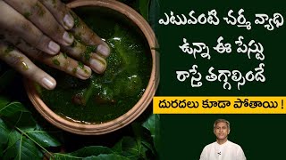 Home Remedy to Treat Skin Rashes | Reduces Itching | Skin Infections | Dr. Manthena