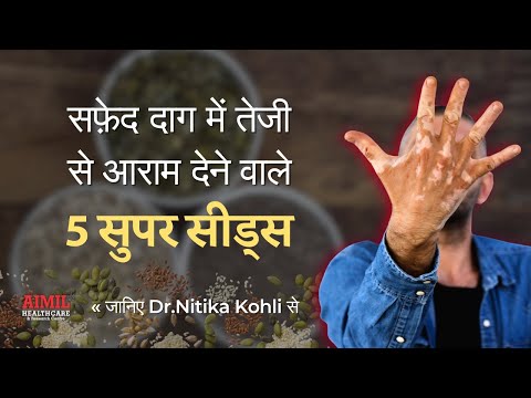 5 Super Seeds for Faster Vitiligo Recovery | Dr. Nitika Kohli Reveals!