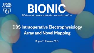 BIONIC: DBS Intraoperative Electrophysiology Array and Novel Mapping