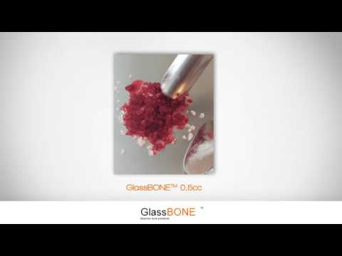 GlassBone - Excelente manipulación gracias a su alta hidrofilia y cohesividad