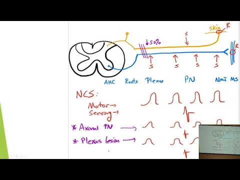 6. Quick Reviews: EMG and Nerve Conduction Study
