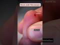 Human Blood Under Microscope Watch All The Blood Cells Biology Mbbs Neet