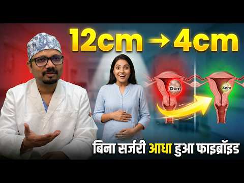 बच्चेदानी की गांठ? अब सिर्फ एक इंजेक्शन से होगा पक्का इलाज
