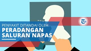Asma (Asthma), Penyakit yang Ditandai oleh Peradangan pada Saluran Pernapasan