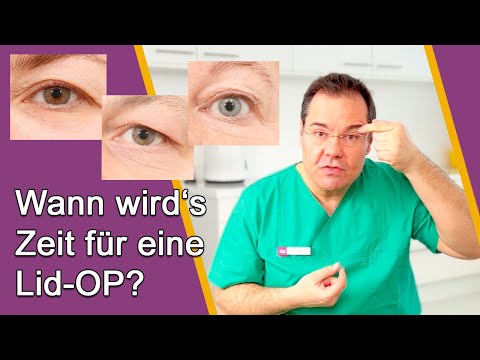 Augenlid-OP – Ab wann ist OP sinnvoll? Gibt es Alternativen ohne OP? Dr. Günther Düsseldorf