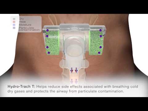 Intersurgicals hydrotrach-t hme for use on tracheostomised p...