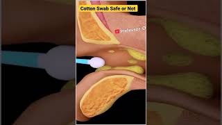 Download lagu 99% யாருக்கும் தெரியாத சுவாரசியமான விஷயங்கள்| How Cotton swab damage the ears| YP Tamil Facts#shorts mp3 Download lagu 99% யாருக்கும் தெரியாத சுவாரசியமான விஷயங்கள்| How Cotton swab damage the ears| YP Tamil Facts#shorts mp3