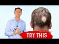 Onions The Best Food For Alopecia Treatment Dr Berg