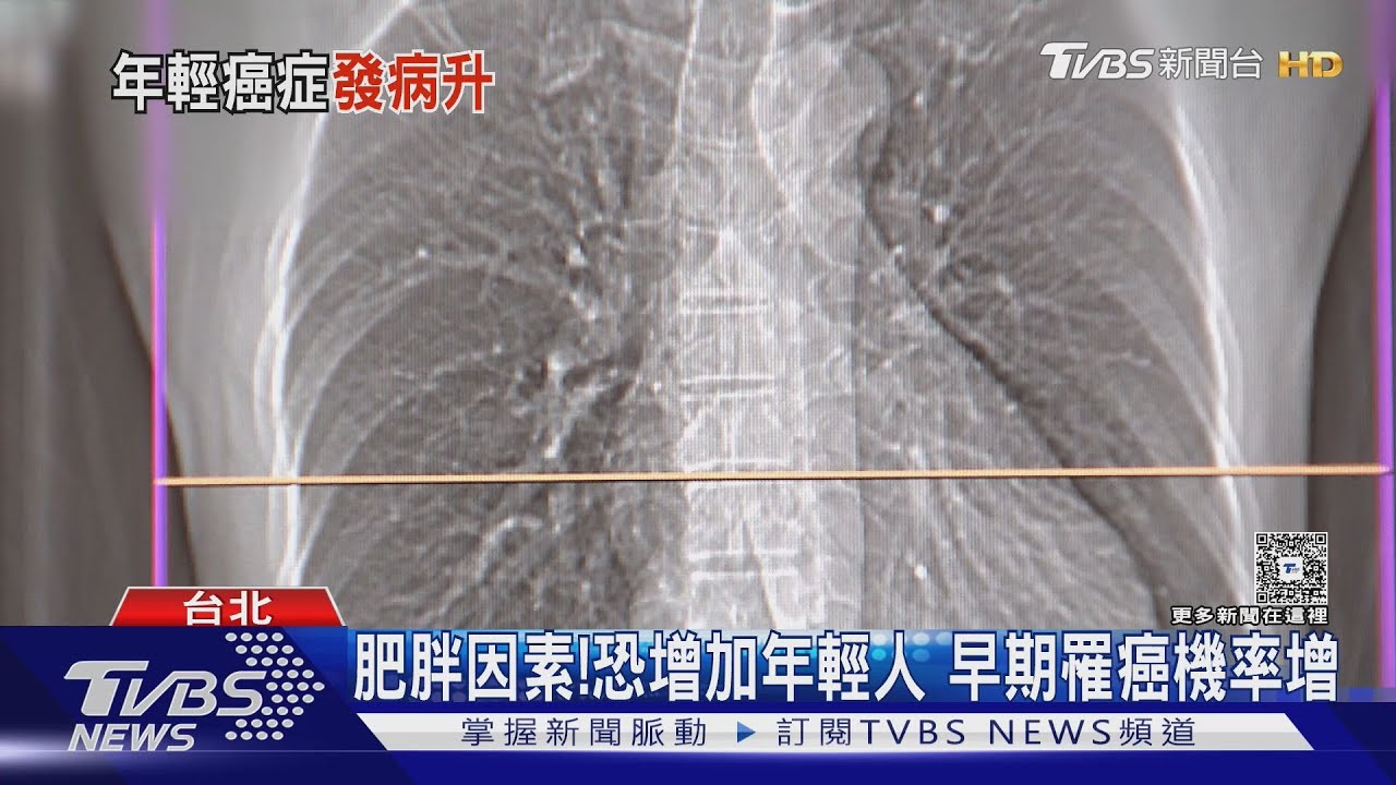 年輕人14 種癌症發病率高 美衛生研究院:警告改掉「這習慣」降低罹癌風險!