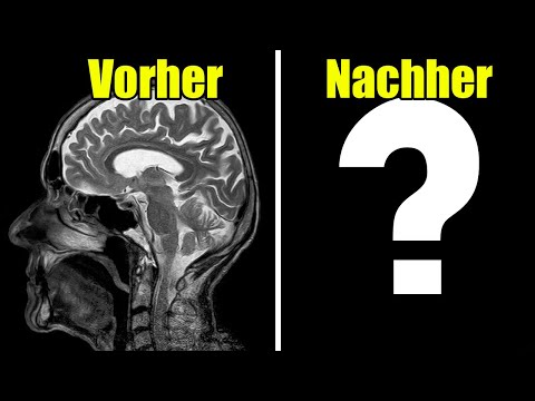 Wie gefährlich sind Magnetfelder?