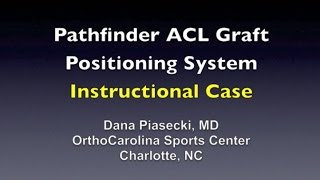 Pathfinder ACL Graft Positioning System - Instructional