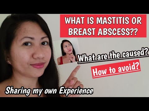 SHARING MY OWN EXPERIENCED| ANO ANG MASTITIS OR BREAST ABSCESS?|ANO ANG DAHILAN AT PAANO MAIIWASAN?