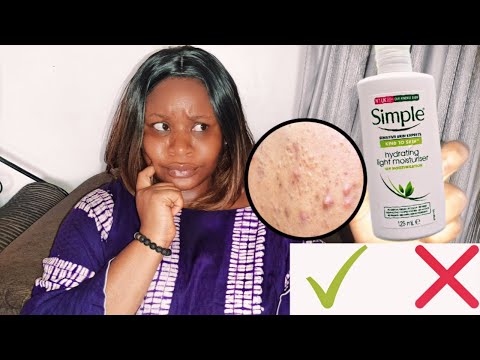I tried This Simple Product & This Happened!! | Simple Hydrating Light Moisturizer Review