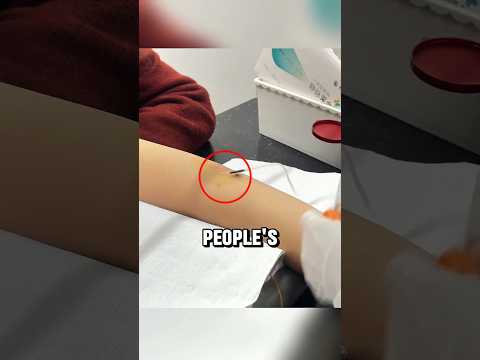 Flying Needle 💉🤯 EXPLAINED