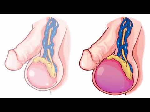 Fármaco para el tratamiento de osteocondrosis Alflutop para juntas en tabletas