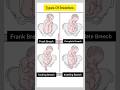 Breech Presentation Types Of Breech Presentation Breech Position Obgyn Position Neet Shorts