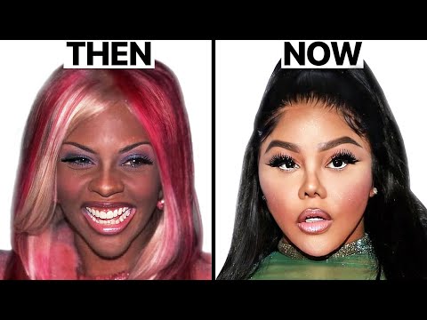 Lil Kim Plastic Surgeries - Surgeon Reacts