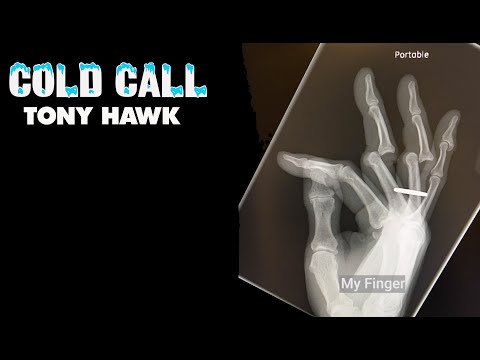 Cold Call: Tony Hawk
