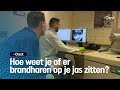 Zo ziet de eikenprocessierups eruit onder de microscoop