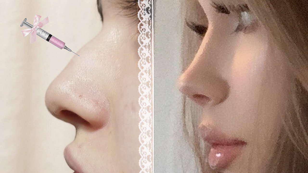 1 𝒳 FIX NOSE 𓏵 TRUE EVE SIDE PROFILE 💉 ⊹ ࣪ ˖ NOSE SHRINKS every second .˚ ୨୧ (EXTREMELY POWERFUL)
