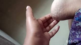 మడామనోప్పితో భాదపడుతున్నారా?ఐతే ఈలా చేస్తే చిటికేలో తగ్గుతుంది.#sudhitalks #healthtips #footheelpain