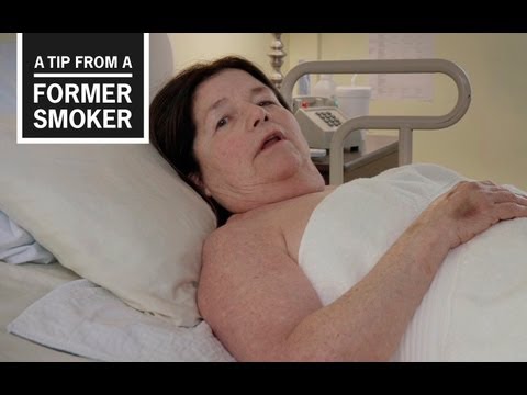CDC: Tips From Former Smokers - Suzy E.’s Tip Ad