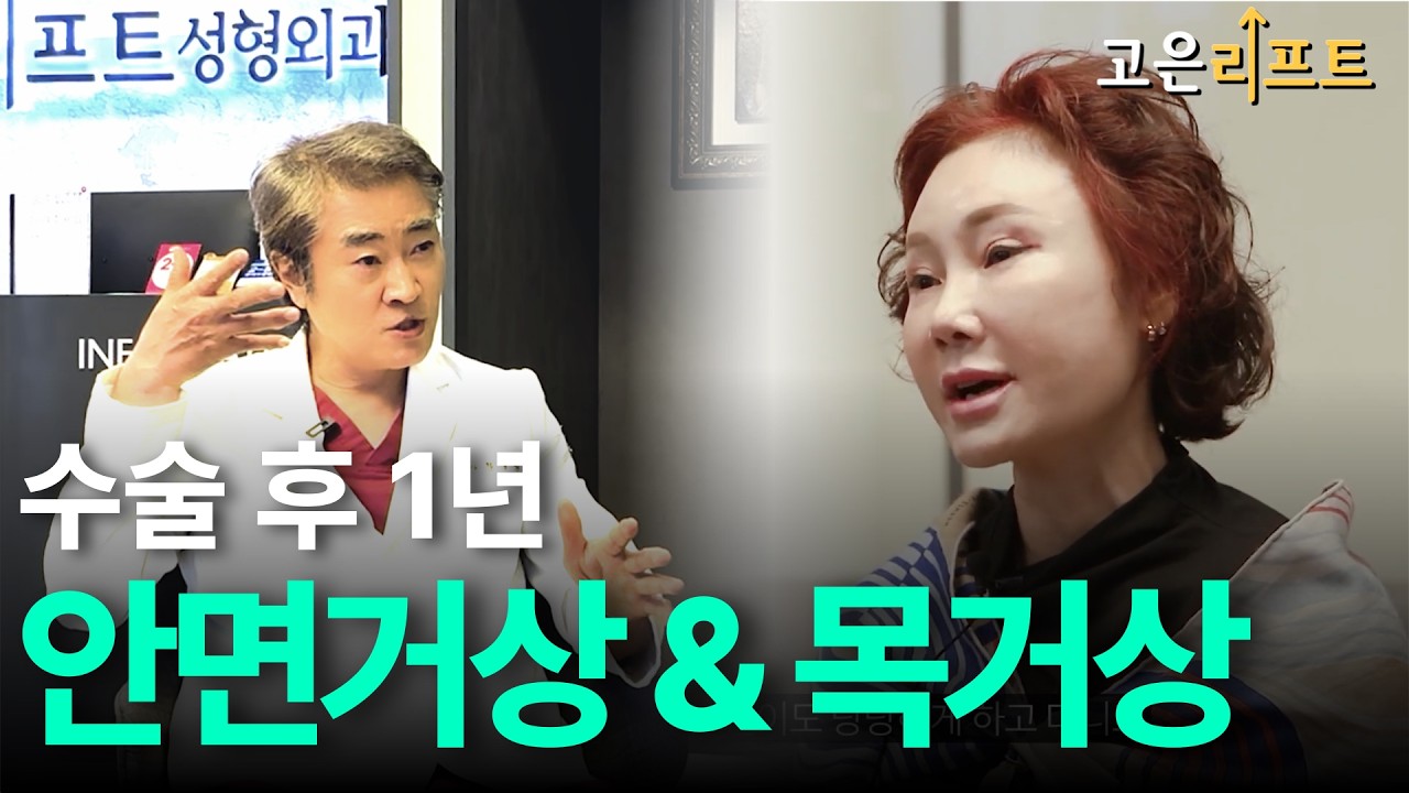 고은리프트 안면거상 목거상 1년 후 유튜브 영상