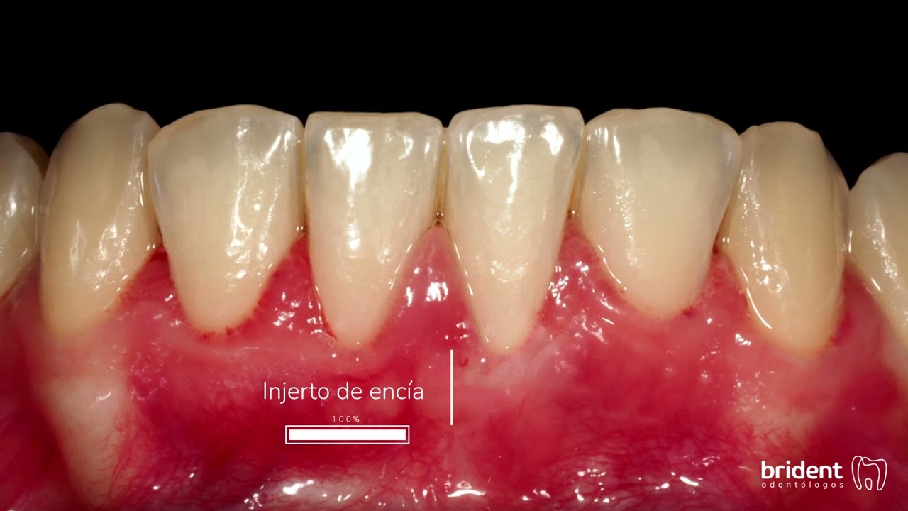 Guillermo Moreno Masiá-98