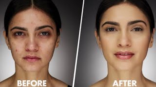 Purify Your Blood For Glowing And Ageless Skin | Dr. Vivek Joshi