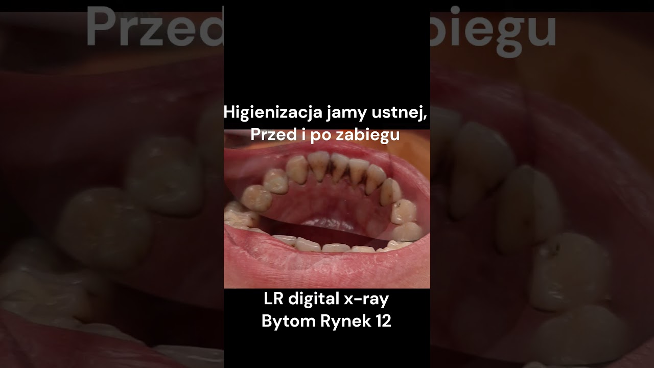 Grażyna Andruszkiewicz-92