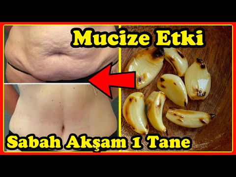 , title : 'Sarımsak Mucizesi||4 Haftada 12 Kilo Verdiren Zayıflama Yöntemi İle Kabızlık Şişkinlik Ödem Bitsin'