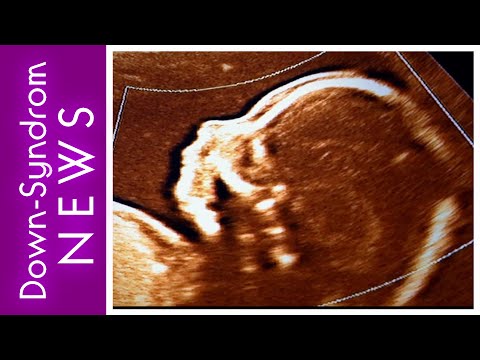 Lebens-Entscheidungen: Am Anfang - Entscheidungen vor der Geburt