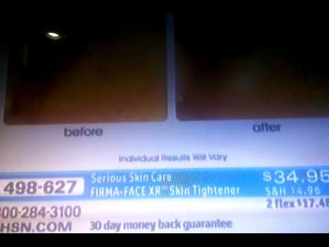 Stallones serious skin care. Model alicia arden