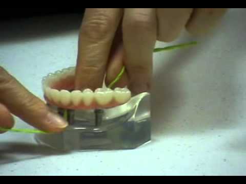 Hygienist demonstrates the use of X-Floss