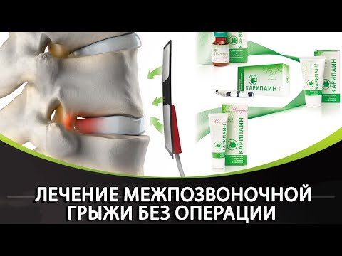 Рассеянность и остеохондроз Что такое функциональная нестабильность шейного отдела позвоночника