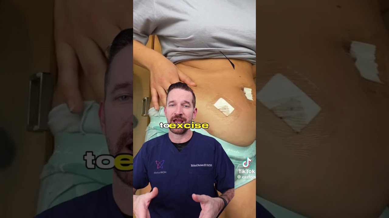 Laparoscopic Endometriosis Surgery Recovery