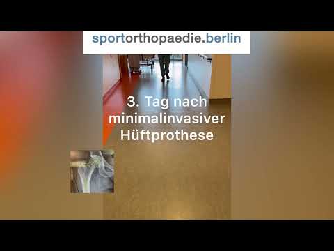 Minimalinvasive Hüftprothese