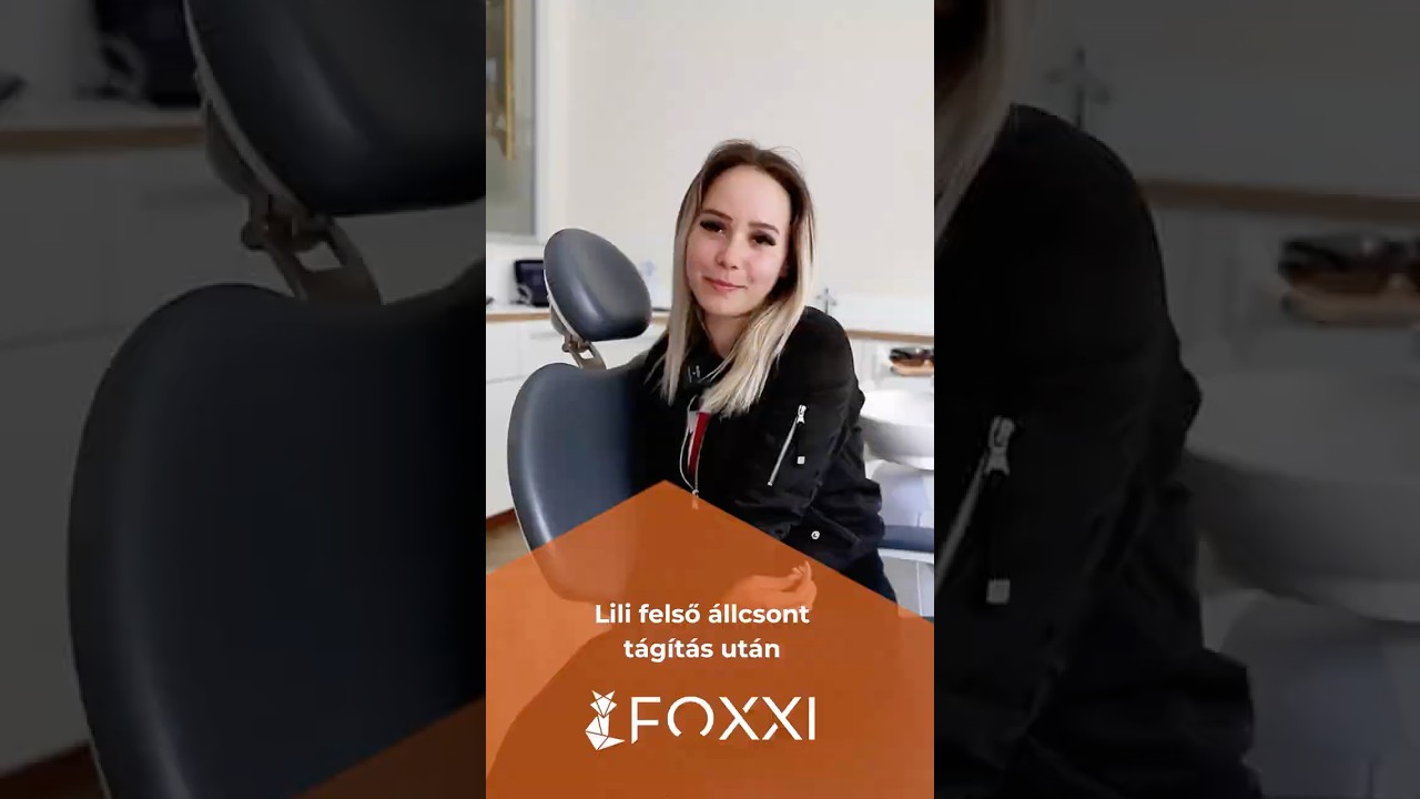 Lili felső állcsont tágítás után